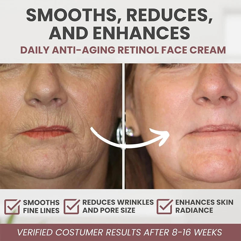 Instant Retinol Cream – Anti-Aging, Firming & Wrinkle Repair