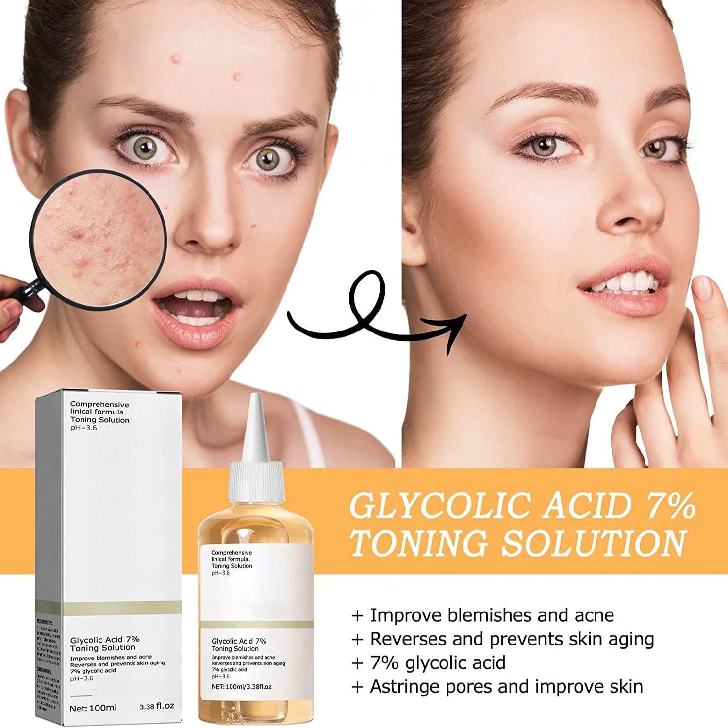 Glycolic Acid 7% Toning Solution – Exfoliating & Skin Renewal