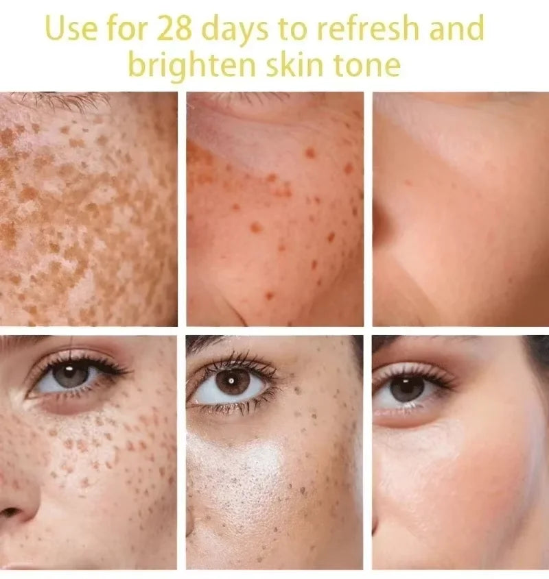 Dark Spot Remover Serum – Brightening & Anti-Pigmentation