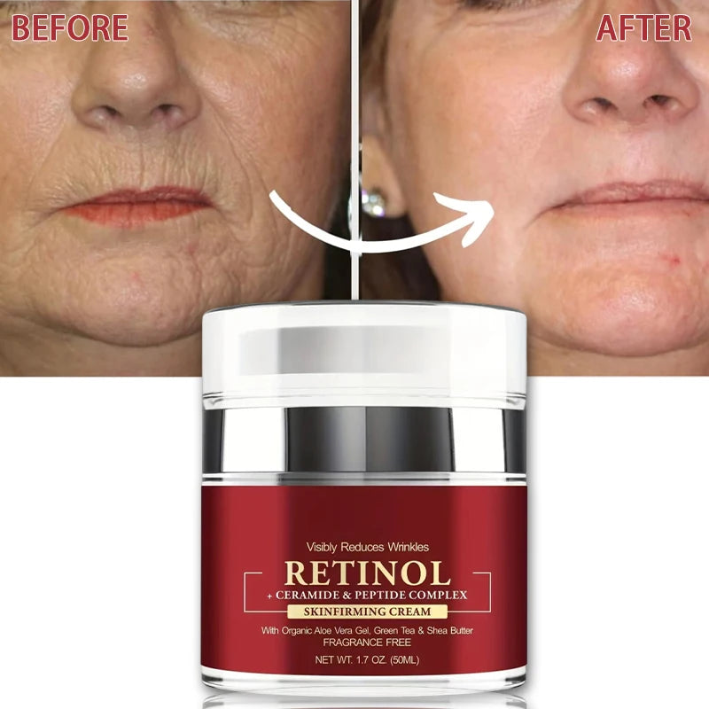 Instant Retinol Cream – Anti-Aging, Firming & Wrinkle Repair