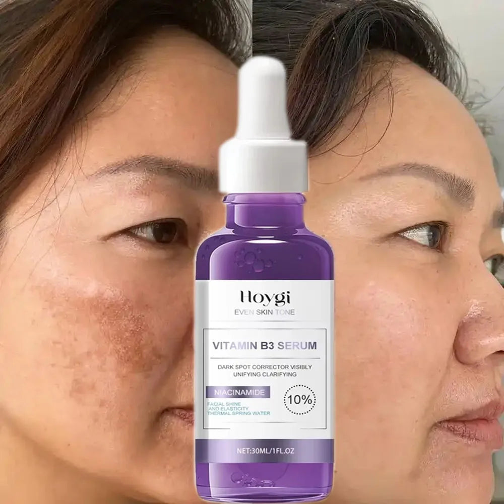 Dark Spot Remover Serum – Brightening & Anti-Pigmentation