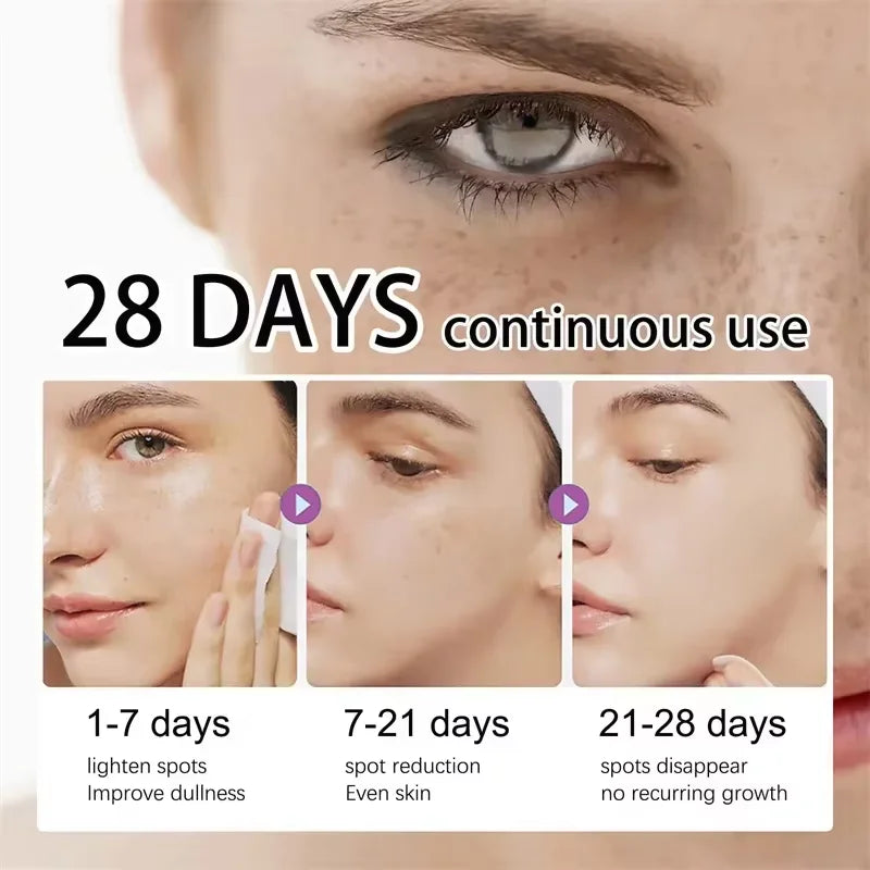 Dark Spot Remover Serum – Brightening & Anti-Pigmentation
