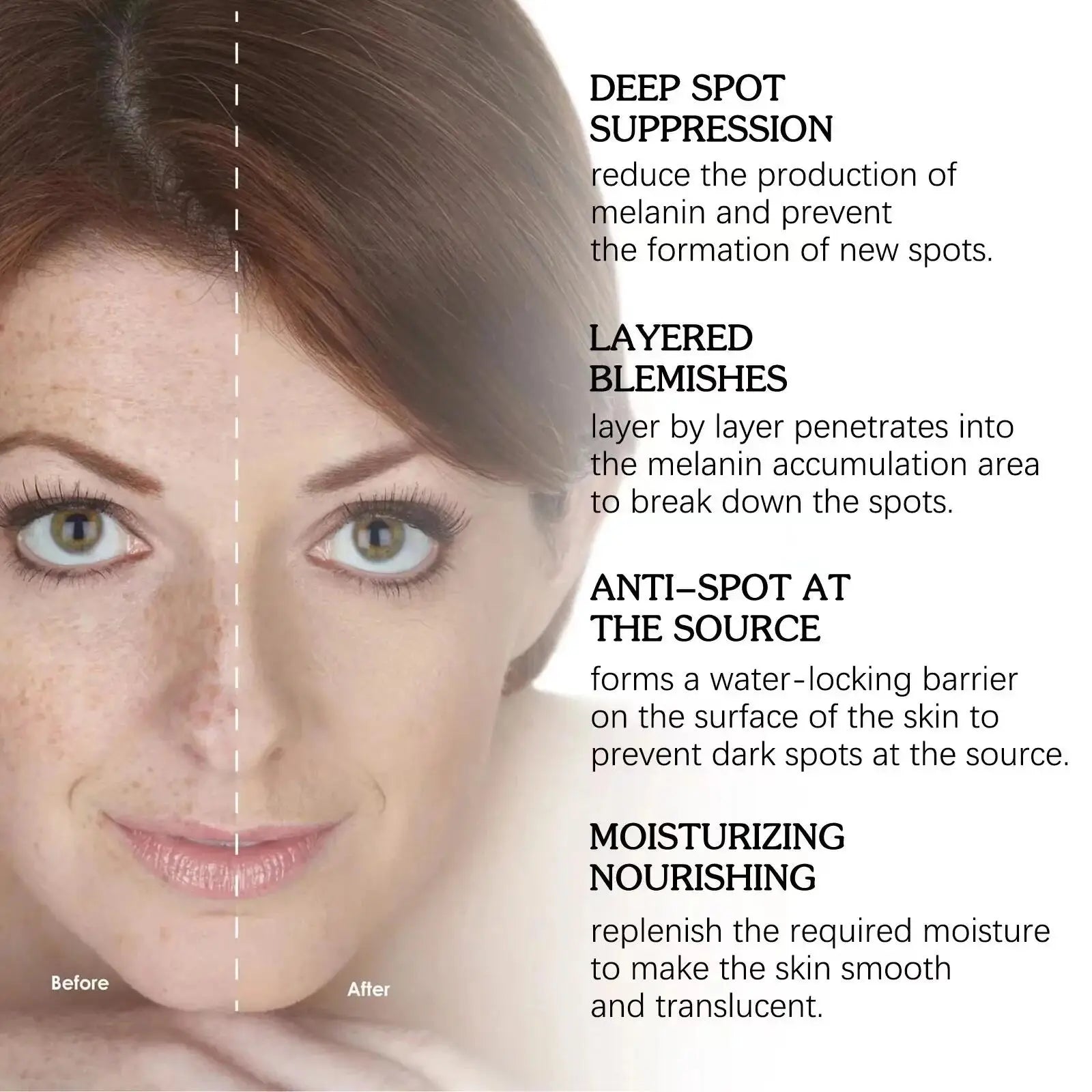 Dark Spot Remover Serum – Brightening & Anti-Pigmentation